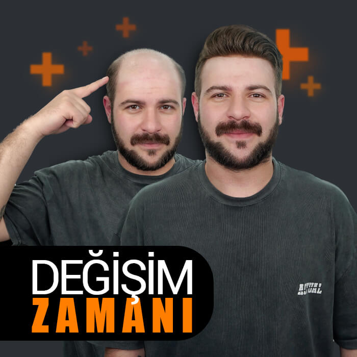 ucuz protez saç